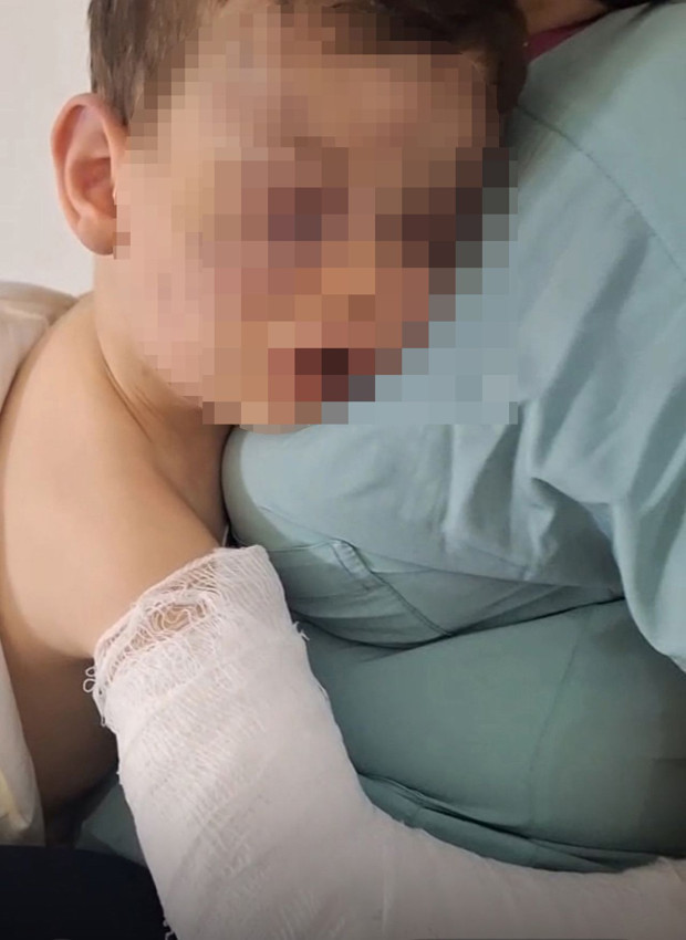 2 yaşındaki bebeği döve döve hastanelik ettiler: Tanık doktorun ifadesi kan dondurdu - Resim: 2