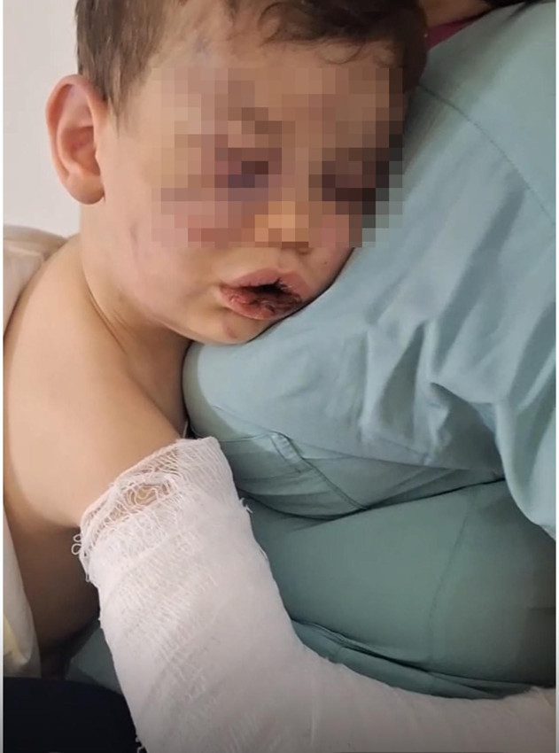 Annesinin sevgilisi dehşeti yaşattı: 2 yaşındaki bebek hastanelik oldu - Resim: 4