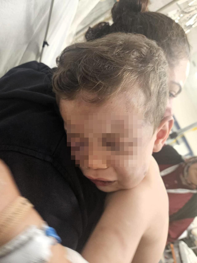 Annesinin sevgilisi dehşeti yaşattı: 2 yaşındaki bebek hastanelik oldu - Resim: 1