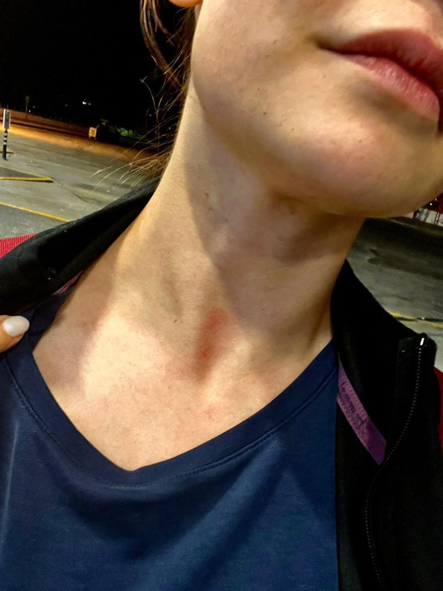 Yolcu otobüsünde skandal: Kadın yolcuyu döve döve araçtan indirip, sokak ortasına terk ettiler! - Resim: 1