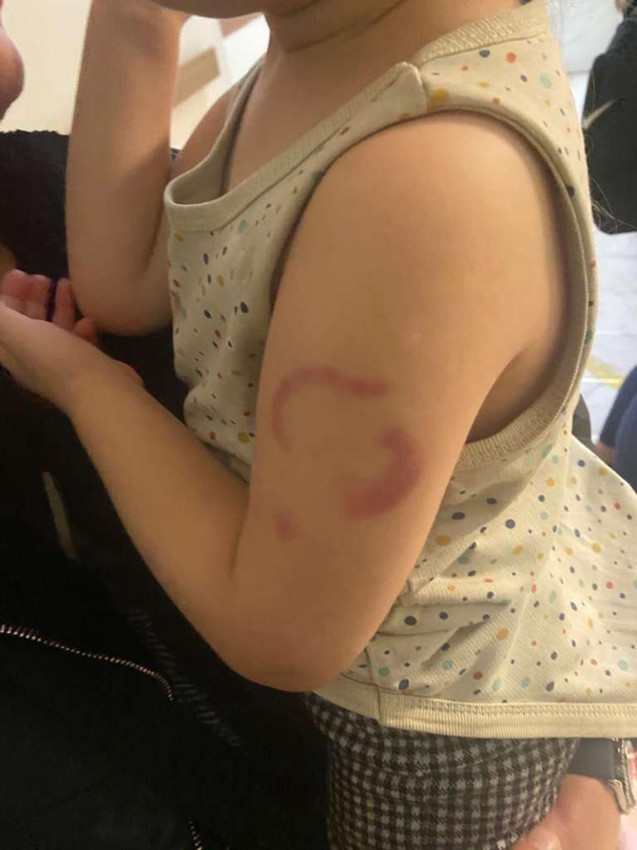 Özel kreşte skandal: Uyuyakalan 3 yaşındaki çocuğa kabusu yaşattı! - Resim: 2