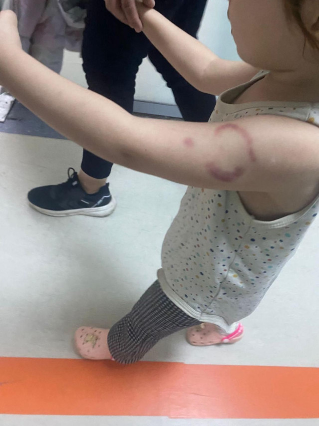 Özel kreşte skandal: Uyuyakalan 3 yaşındaki çocuğa kabusu yaşattı! - Resim: 4