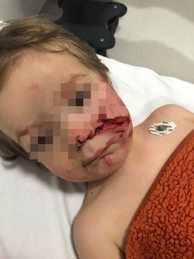 Komşunun pitbullu biri 1,5 diğeri 5 yaşındaki iki çocuğu hastanelik etti - Resim: 3