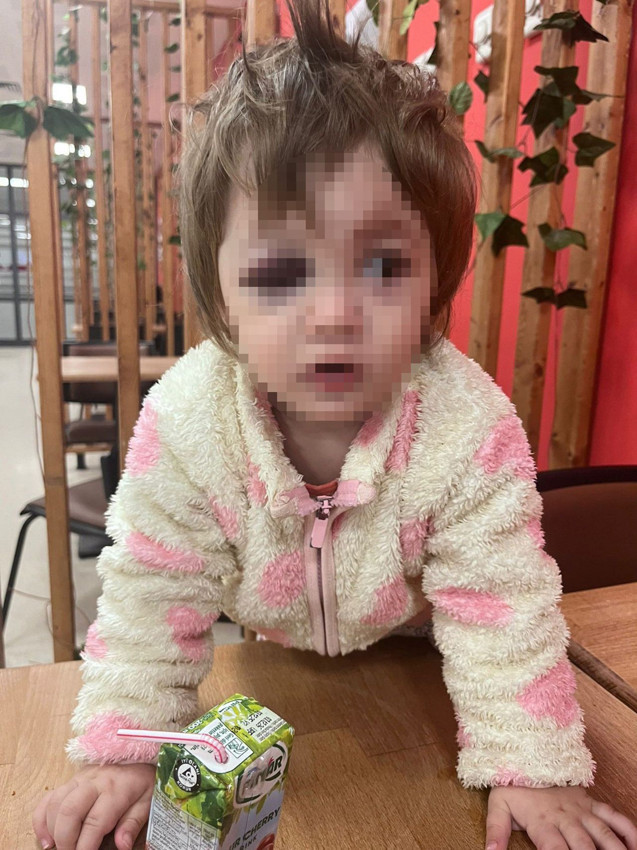 14 aylık bebeğin kafatasını çatlatan korkunç saldırı güvenlik kamerasında - Resim: 2