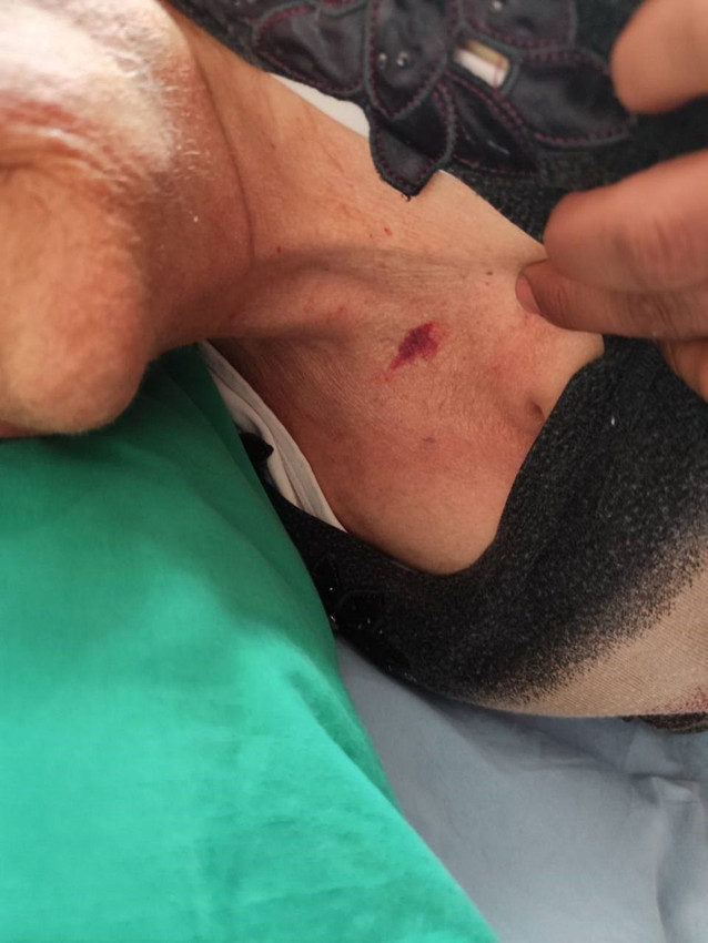 Özel hastanenin yoğun bakım ünitesinde skandal iddia: ''Darp edip, kolunu kırmışlar'' - Resim: 2