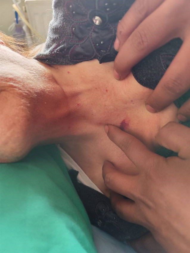 Özel hastanenin yoğun bakım ünitesinde skandal iddia: ''Darp edip, kolunu kırmışlar'' - Resim: 4