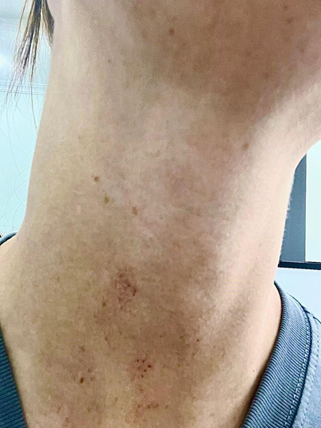 Yolcu otobüsünde skandal: Kadın yolcuyu döve döve araçtan indirip, sokak ortasına terk ettiler! - Resim: 2