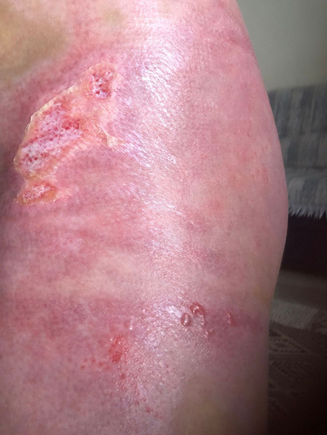 Düğündeki saçma sapan şov 8 yaşındaki bir çocuğun hayatını altüst etti - Resim: 2