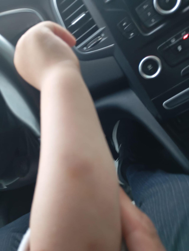 Bu ne biçim anne ? 1,5 yaşındaki minik kıza akılalmaz şiddet... - Resim: 4