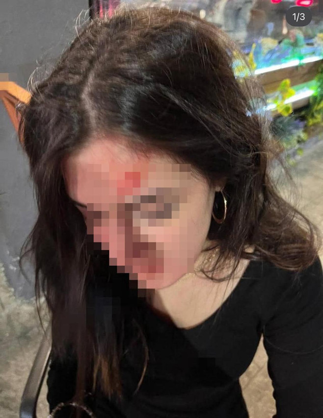 Genç kadına eski sevgili tuzağı iddiası olay yarattı! - Resim: 3