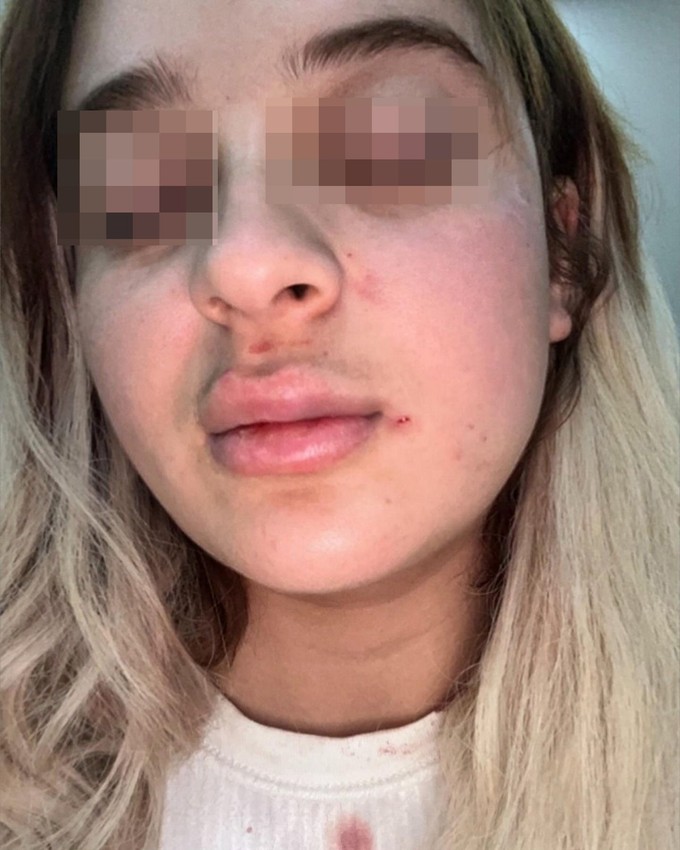Genç kızın bitmeyen kabusu: Öldürmekten beter etti, gözaltına alındıktan sonra serbest kaldı - Resim: 3