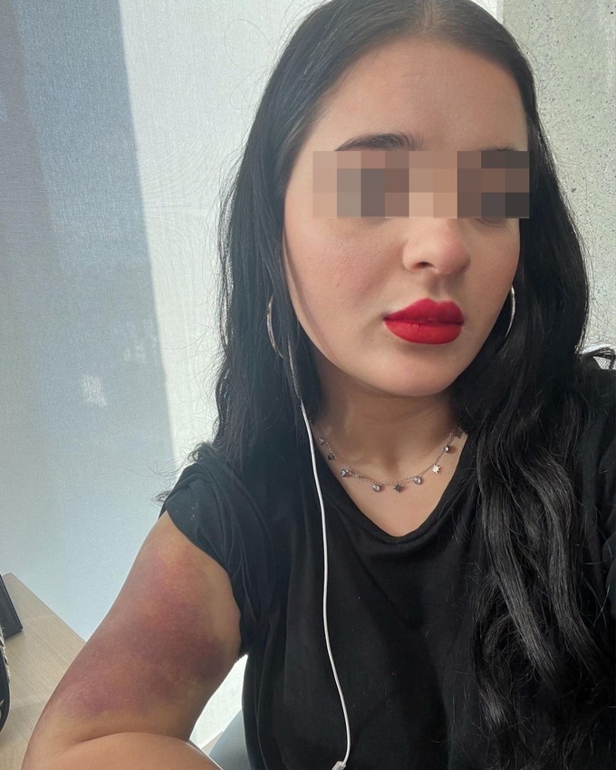 Genç kızın bitmeyen kabusu: Öldürmekten beter etti, gözaltına alındıktan sonra serbest kaldı - Resim: 1