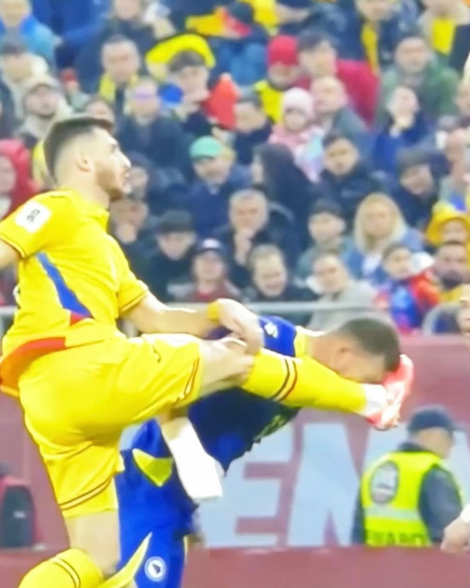 Fenerbahçe'ye kötü haber: Dzeko'nun burnu kırıldı - Resim: 3