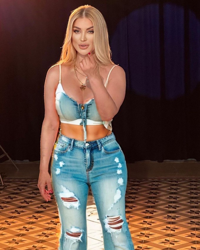 Songül Karlı'nın son estetiği olay oldu: ''Songül Kardashian oldun'' - Resim: 2