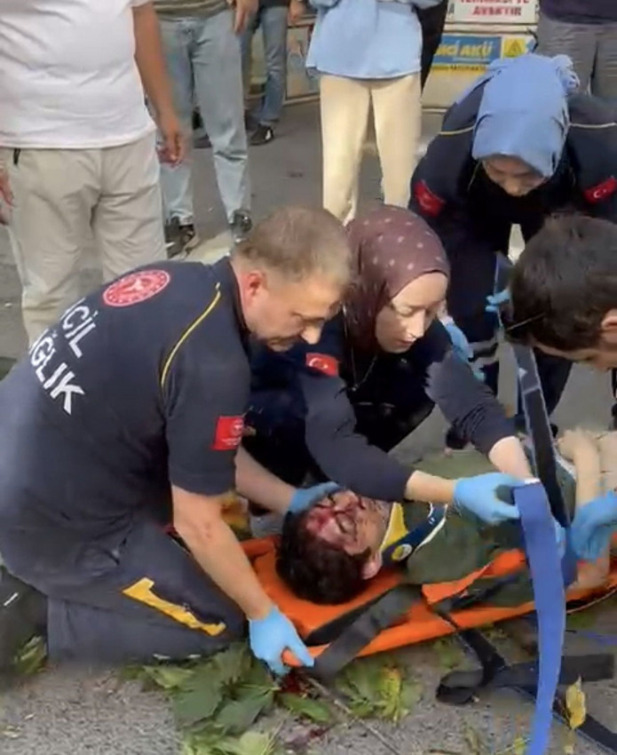 İstanbul'da genç oyuncunun üzerine ağaç devrildi; korkunç olay kamerada - Resim: 4