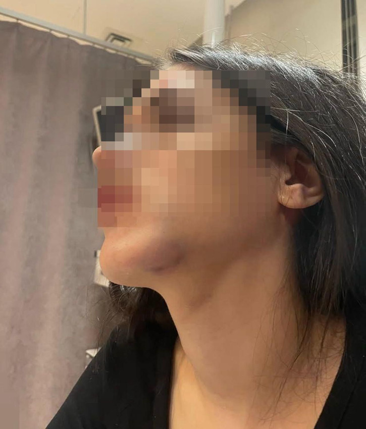 Genç kadına eski sevgili tuzağı iddiası olay yarattı! - Resim: 1