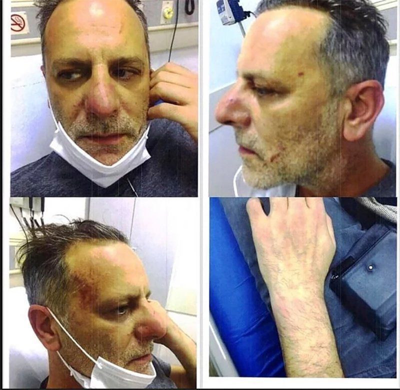Ozan Güven sonunda Deniz Bulutsuz sessizliğini bozdu: O gece yaşananları tek tek anlattı! - Resim: 4