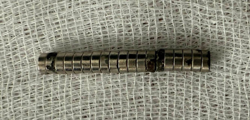 Üç yaşındaki yaramazın boğazından çıkanlar doktorları şoke etti - Resim: 3