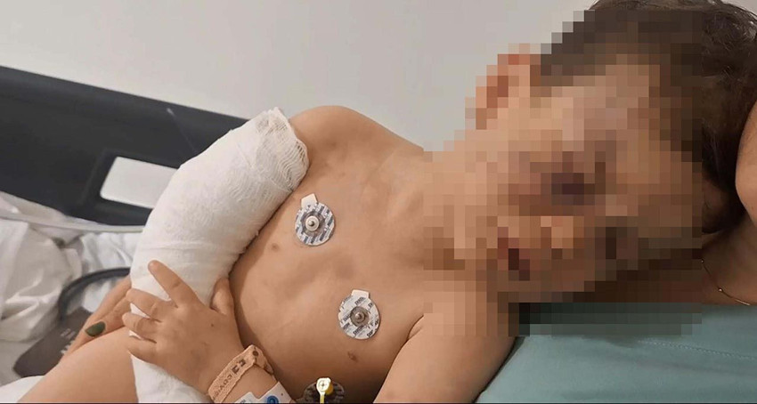 Türkiye'nin konuştuğu 2 yaşındaki bebeğe şiddette kan donduran ifade! - Resim: 4