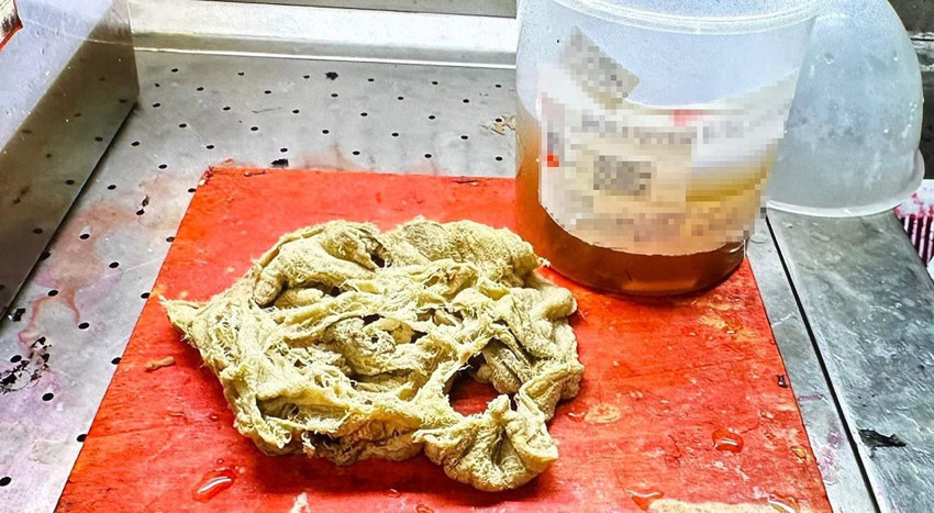 Bakanlık özel hastanedeki akılalmaz skandala 2 yıl sonra soruşturma izni verdi! - Resim: 3