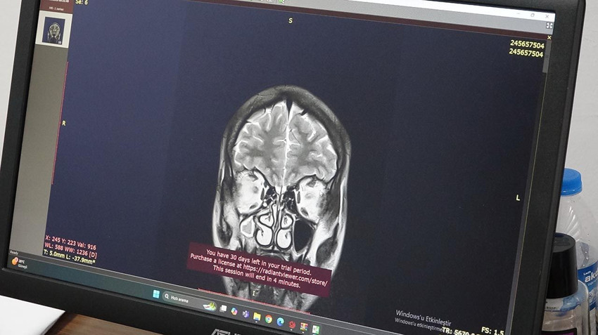 Türkiye'de de vaka sayısı hızla artan çağın yeni kabusu için kritik uyarı - Resim: 1