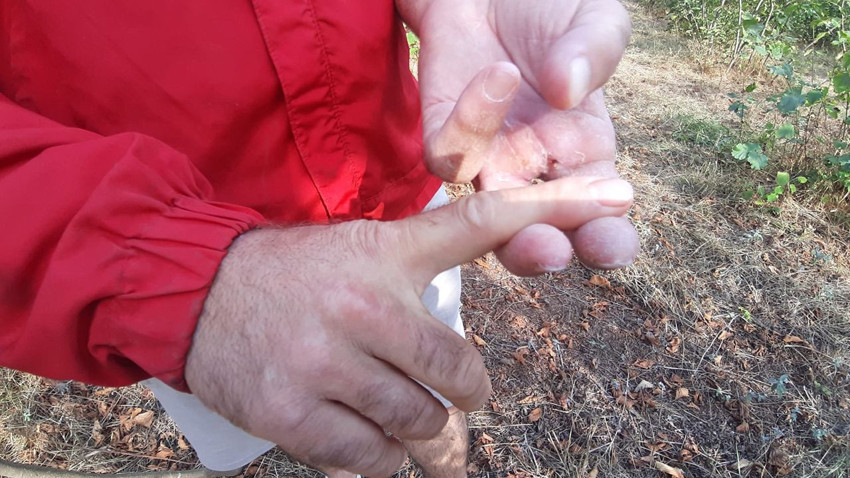 Ayı saldırısından mucize bir şekilde kurtulan çiftçi yaşadığı kabusu anlatı - Resim: 3