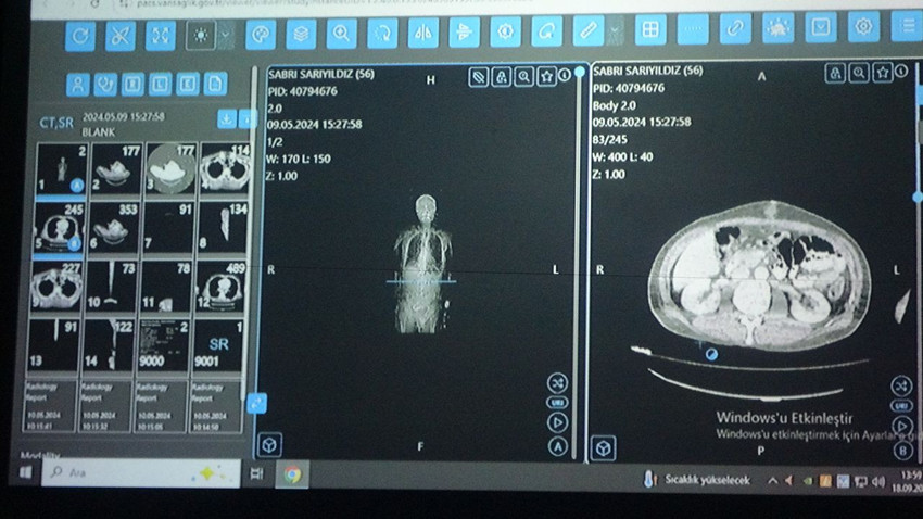 Türk bilim insanlarının yapay zeka ile kanser tedavisi planlaması ilk testi geçti - Resim: 1