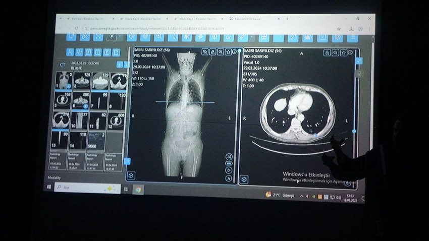 Türk bilim insanlarının yapay zeka ile kanser tedavisi planlaması ilk testi geçti - Resim: 3