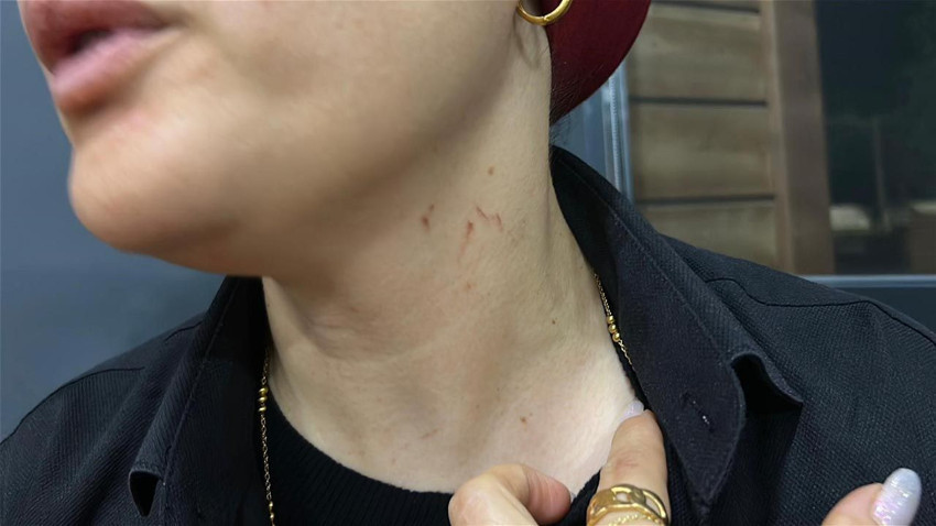 Düğünde ''halay başı'' kavgası: Kadın şarkıcının boğazına sarıldı! - Resim: 4