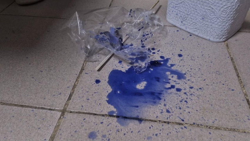 Minik çocuğun en büyük mutluluğu kabusu oldu: Ağzı bir anda köpürmeye başladı - Resim: 4