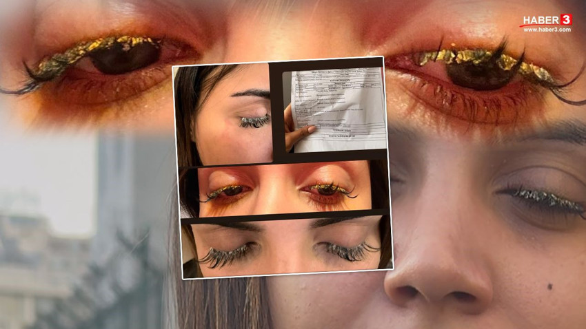 İstanbul'da bir güzellik merkezi skandalı daha: Güzelleşmek isterken kör oluyordu - Resim: 1