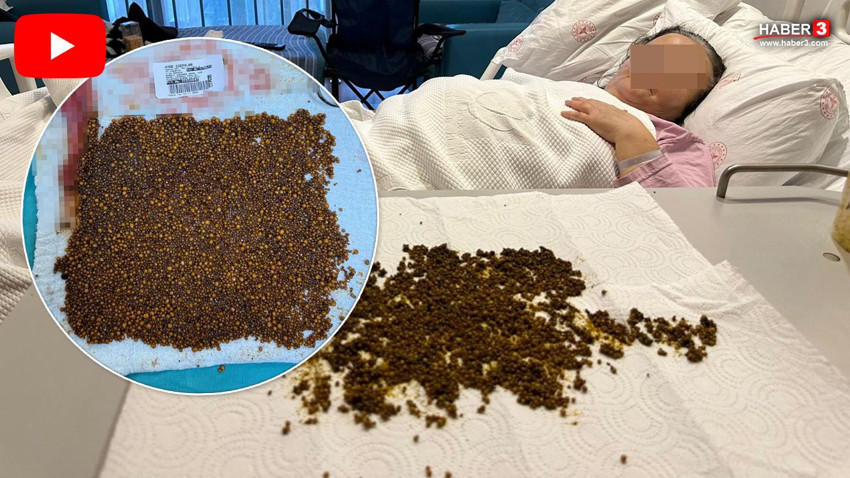 Türkiye'nin ilk yapay zekalı ameliyatında hasta da, doktorlar da şoke oldu! - Resim: 1