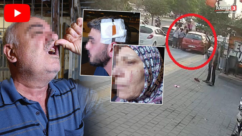 Komşuları bir ailenin hayatını kabusa çevirdi: Dövdü, bıçakladı, dişlerini kırdı - Resim: 1