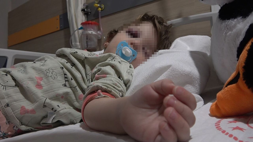 14 aylık bebeğin kafatasını çatlatan korkunç saldırı güvenlik kamerasında - Resim: 3