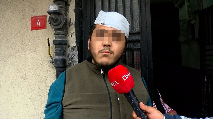 Sizin elleriniz kırılsın be! İstanbul'da zihinsel engelli genci ve annesini sopalarla darbettiler! - Resim: 3