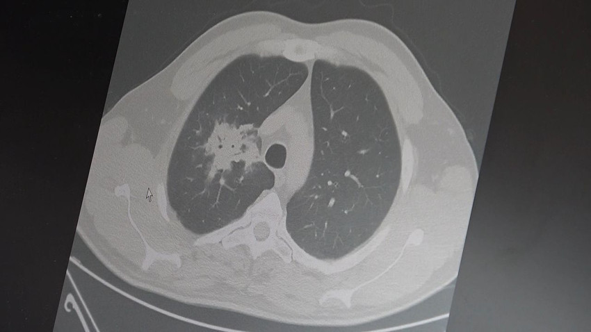 Elektronik sigara ile sokakta, kafede, parkta vapur bacası gibi gezenlere müjde(!) - Resim: 4