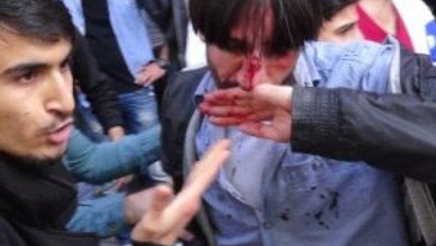 Hdp’liler İle Vatandaşlar Birbirine Girdi