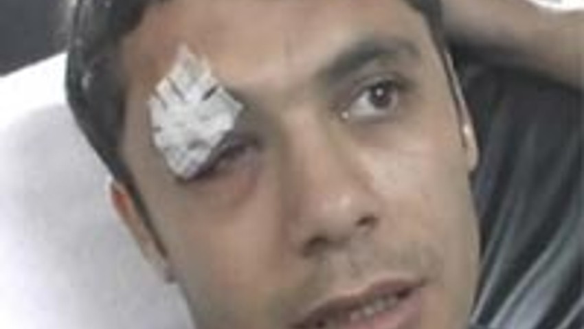 Ahmed Hassan kaza geçirdi !