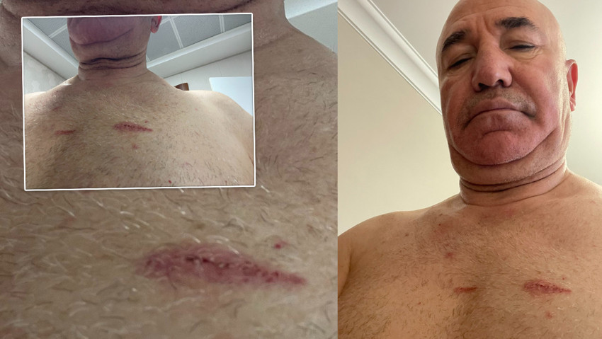 CHP'li milletvekili Mahmut Tanal: ''Polis tarafından darbedildim!''