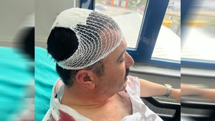 YRP'li İl Başkanı, Belediye başkan yardımcısına saldırıdan tutuklandı