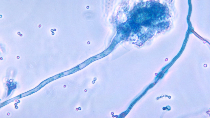 Yeni bir ölümcül hastalık için alarm verildi: ''Bir anda yayılabilir''