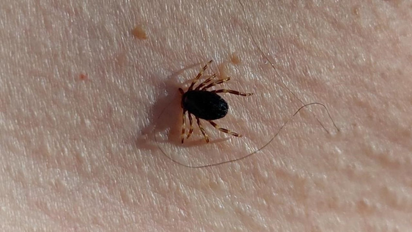 Ölümcül kabusta ilk vaka kayıtlara geçti, uzmanlardan hayati uyarılar geldi - Resim: 2