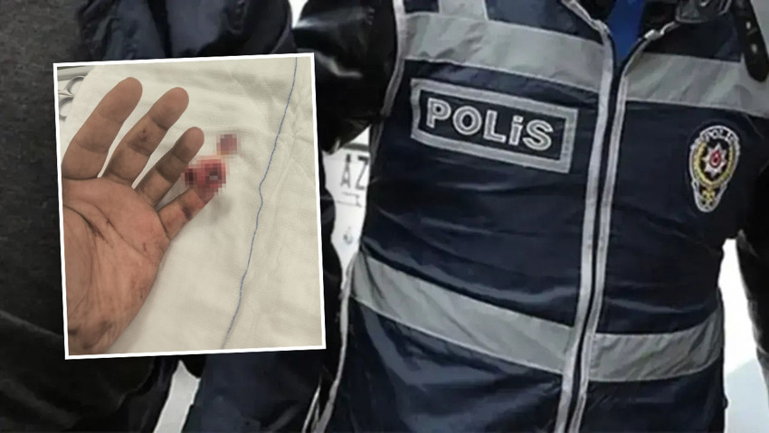 Gözaltına alınırken polisin parmağını kopardı