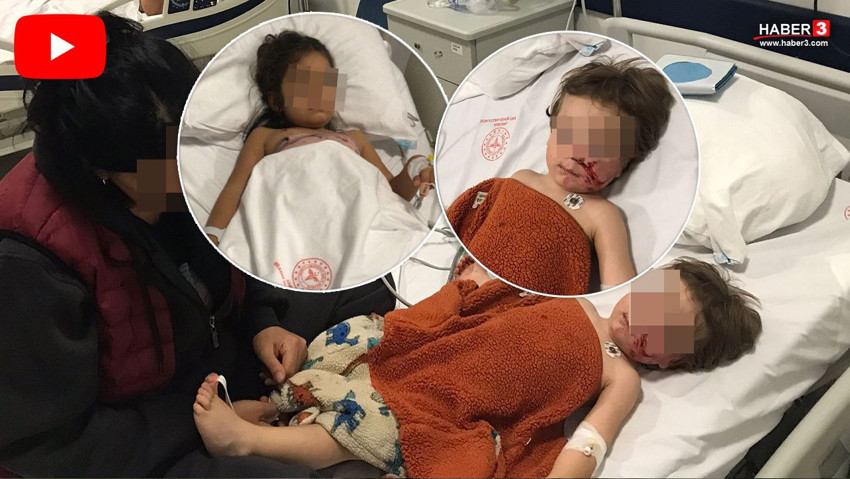 Komşunun pitbullu biri 1,5 diğeri 5 yaşındaki iki çocuğu hastanelik etti - Resim: 1