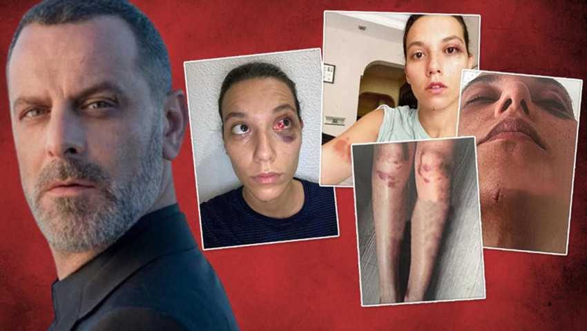 Ozan Güven'e eğlence mekanında soğuk duş: Sloganlar eşliğinde mekandan çıkarıldı! - Resim: 3
