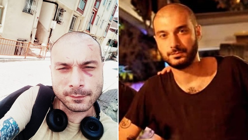Babasını darbeden ünlü rapçi tutuklandı