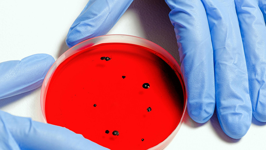 Kabusun yeni adı heliocobacter pylori oldu: Her 2 kişiden birinde görülüyor!