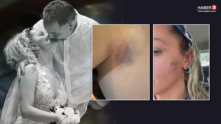 Ünlü oyuncudan şok paylaşım! 7 aylık eşinden şiddet gördüğünü açıkladı