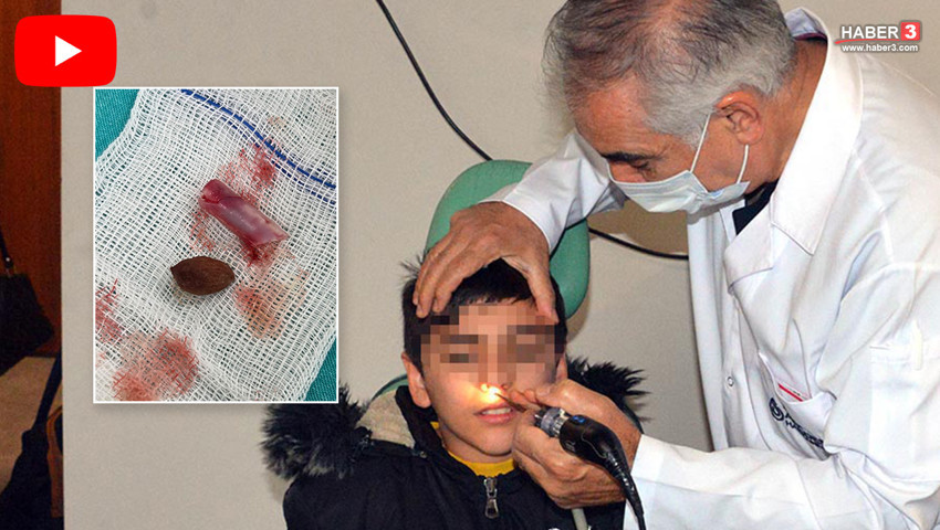 Kaşıntısı olan küçük çocuğun burnundan çıkanlar şaşkına çevirdi