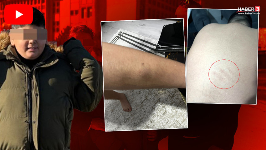 Ankara'da okulda kan donduran iddia: Otizmli öğrenciye şiddete müdür kalkanı!